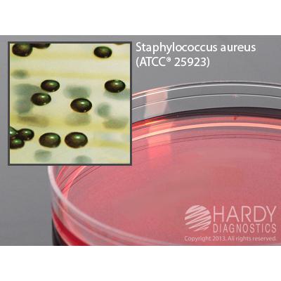 Vogel and Johnson Agar, 15x100mm plate, Hardy Diagnostics