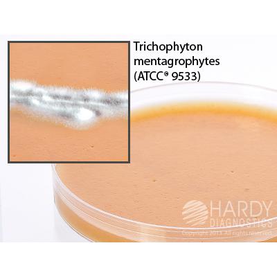 V9 Agar (V8 juice and potato flakes), for mycology, 15x100mm plate, Hardy Diagnostics