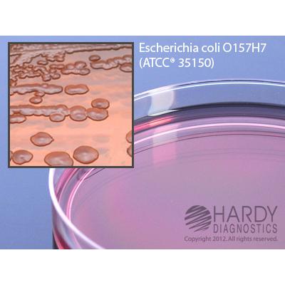 MacConkey Agar with Sorbitol (SMAC), for E. coli O157, 15x100mm plate, Hardy Diagnostics